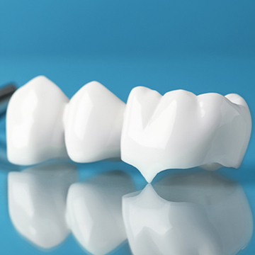 Dental Crown lengthening in Largo