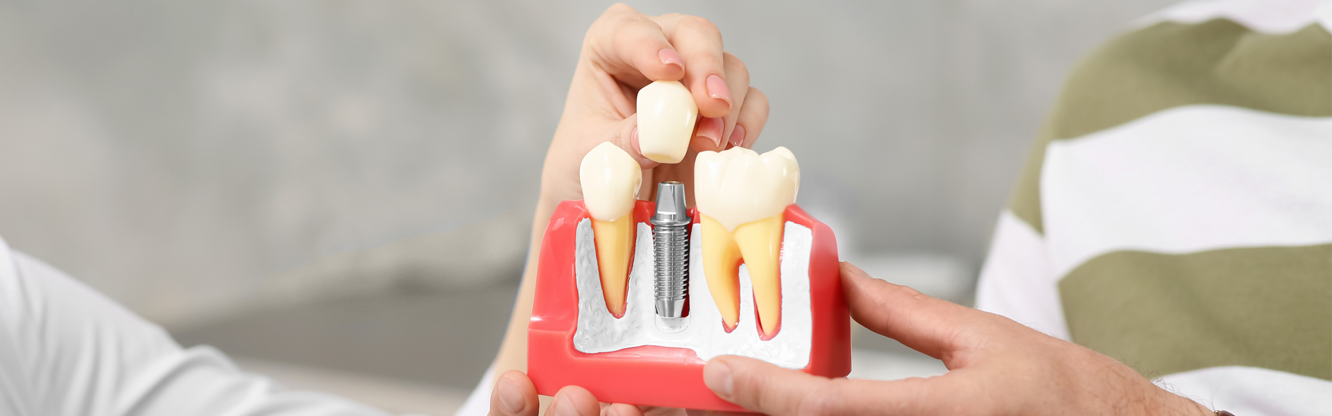 When Are Dental Implants Medically Necessary?
