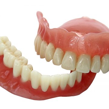 Unveiling the Unmatched Benefits of Opting for Dental Implants Over Traditional Dentures