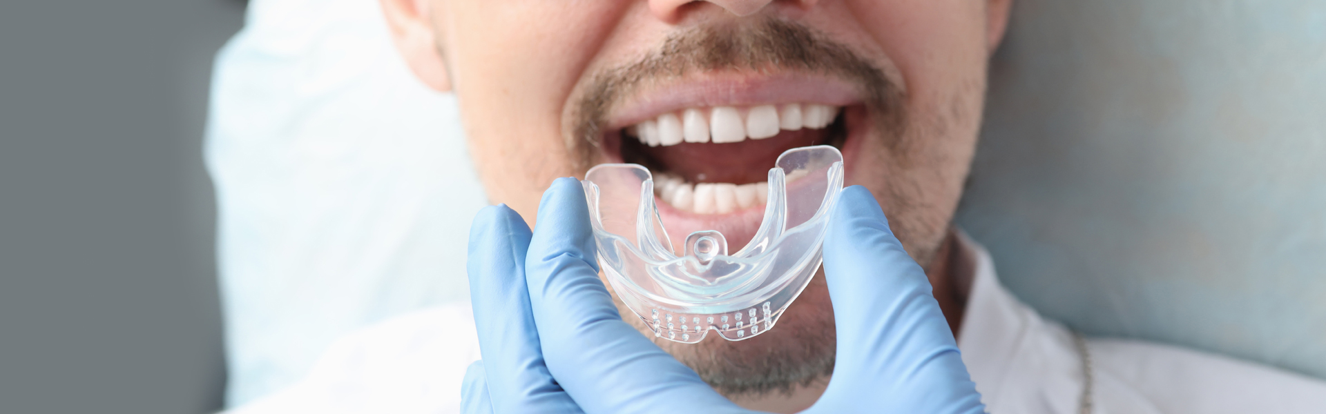 Shield Your Smile: Custom Mouth Guards in Largo