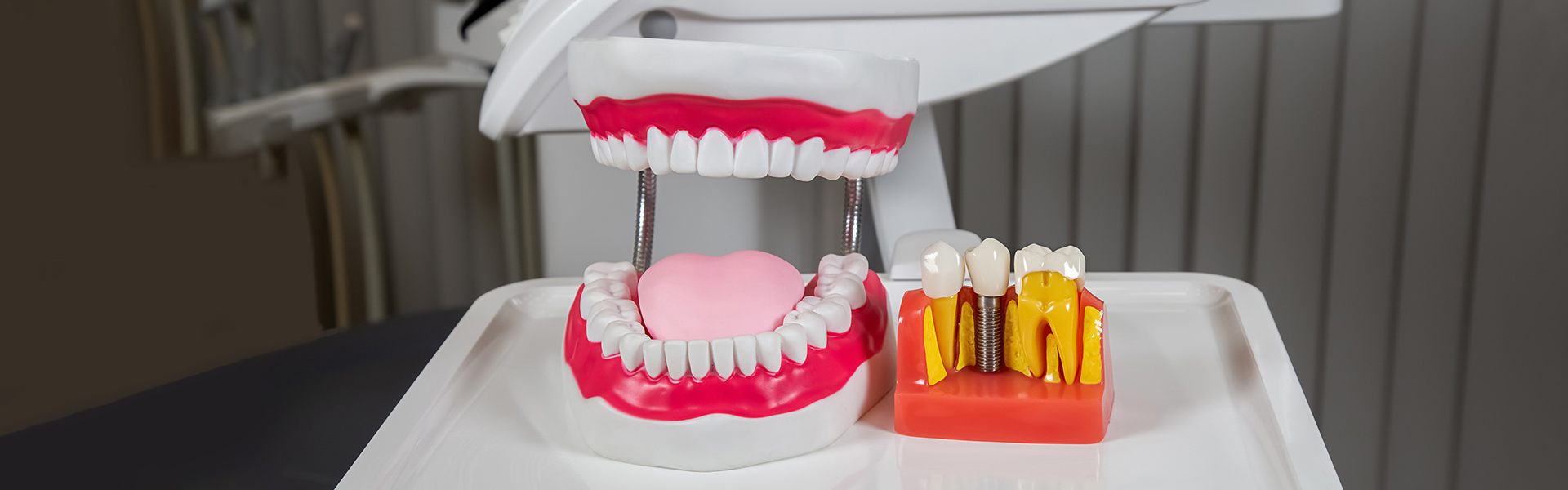 How to Choose the Right Teeth Implant Specialist in Largo